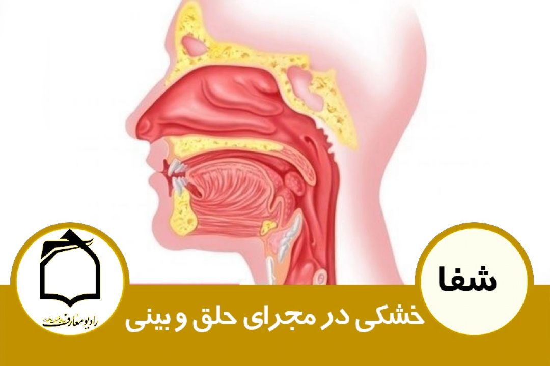 خشكی در مجرای حلق و بینی