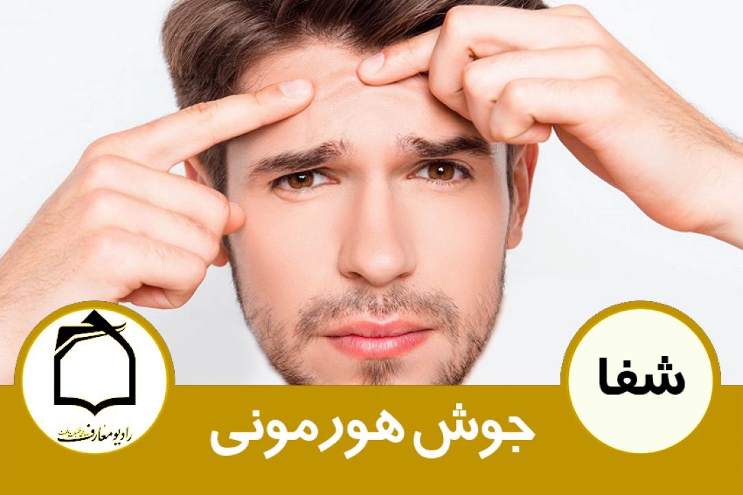 درمان جوش های هورمونی 