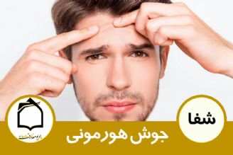 درمان جوش های هورمونی 