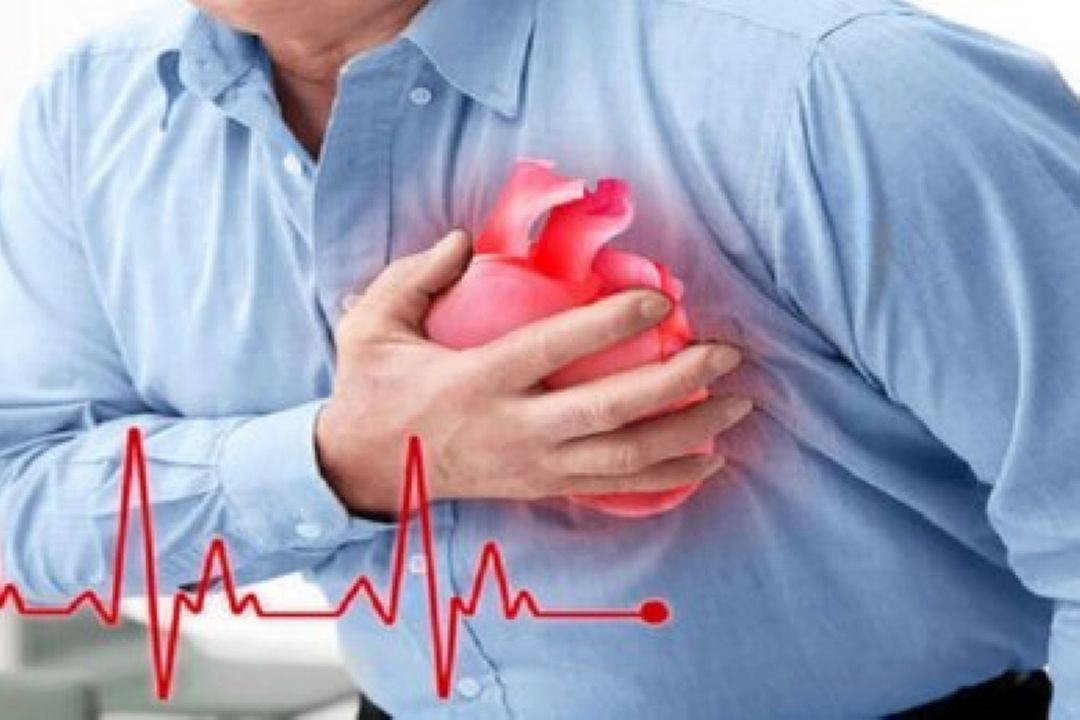 What to know about cardiovascular disease