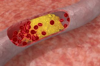 چربی خون بالا و تاثیر روزه داری بر آن