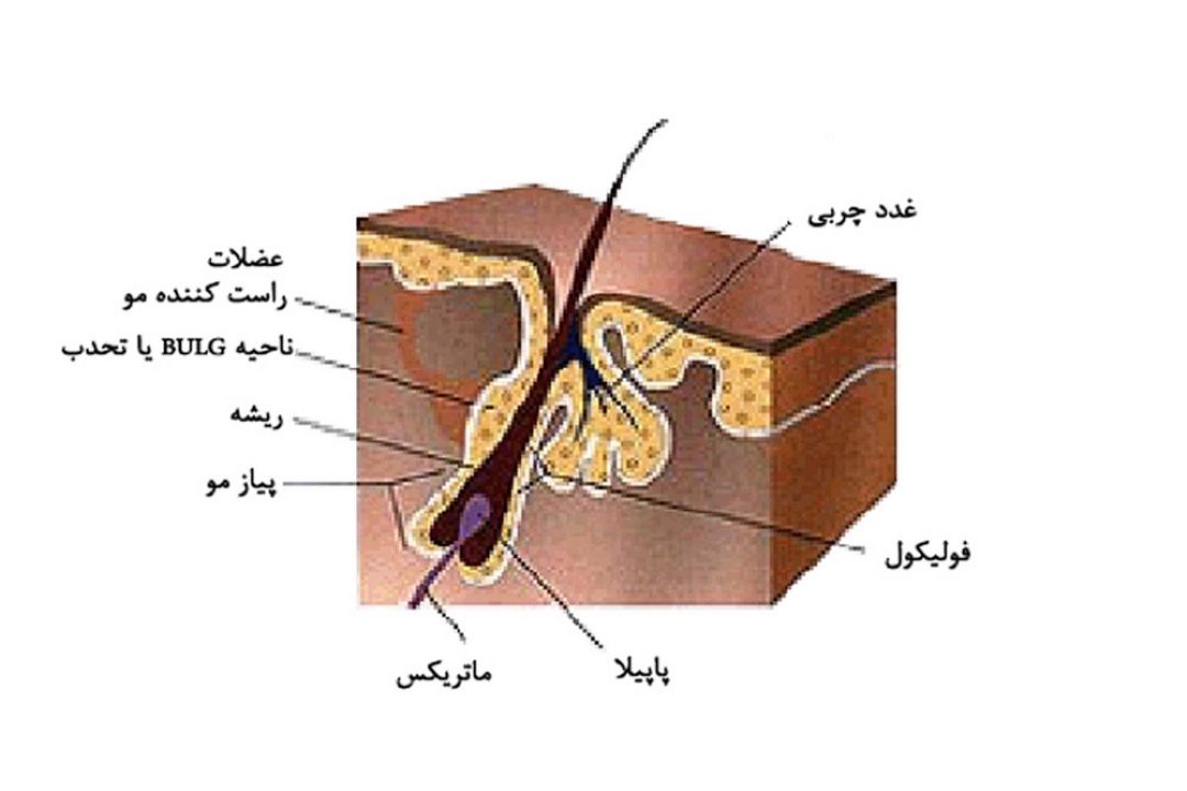 با موهای زائد چه كنیم؟