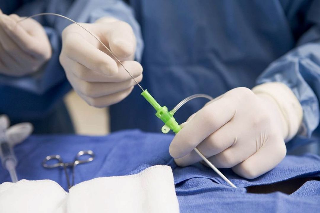 آنژیوگرافی چیست و چه كاربردی دارد؟