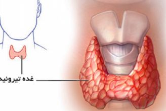 در برنامه نبض دوشنبه شانزدهم مرداد درباره تیروئید كم كار در كسانی كه قرص قند میخورند صحبت میكنیم