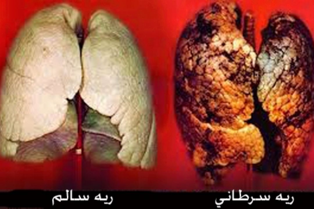 نبض