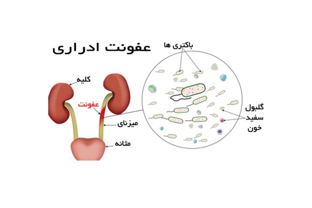 در برنامه نبض یكشنبه بیست و ششم شهریور درباره درمان عفونت ادراری در بیماران مبتلا به ام اس صحبت میكنیم.