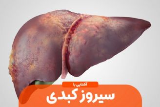  آیا چاقی باعث بروز سیروز كبدی می شود؟